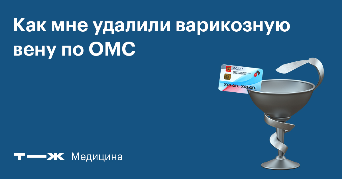 Варикоз Операция По Омс