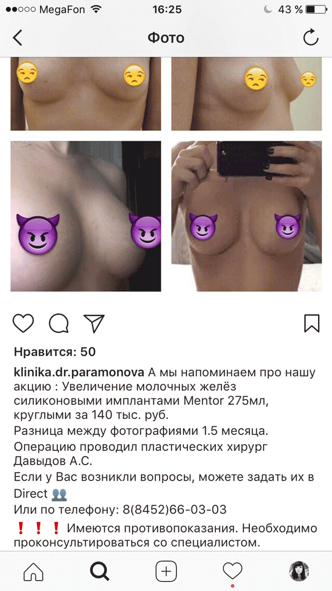 В медуслугах нужно советовать проконсультироваться со специалистом. Можно советовать своего