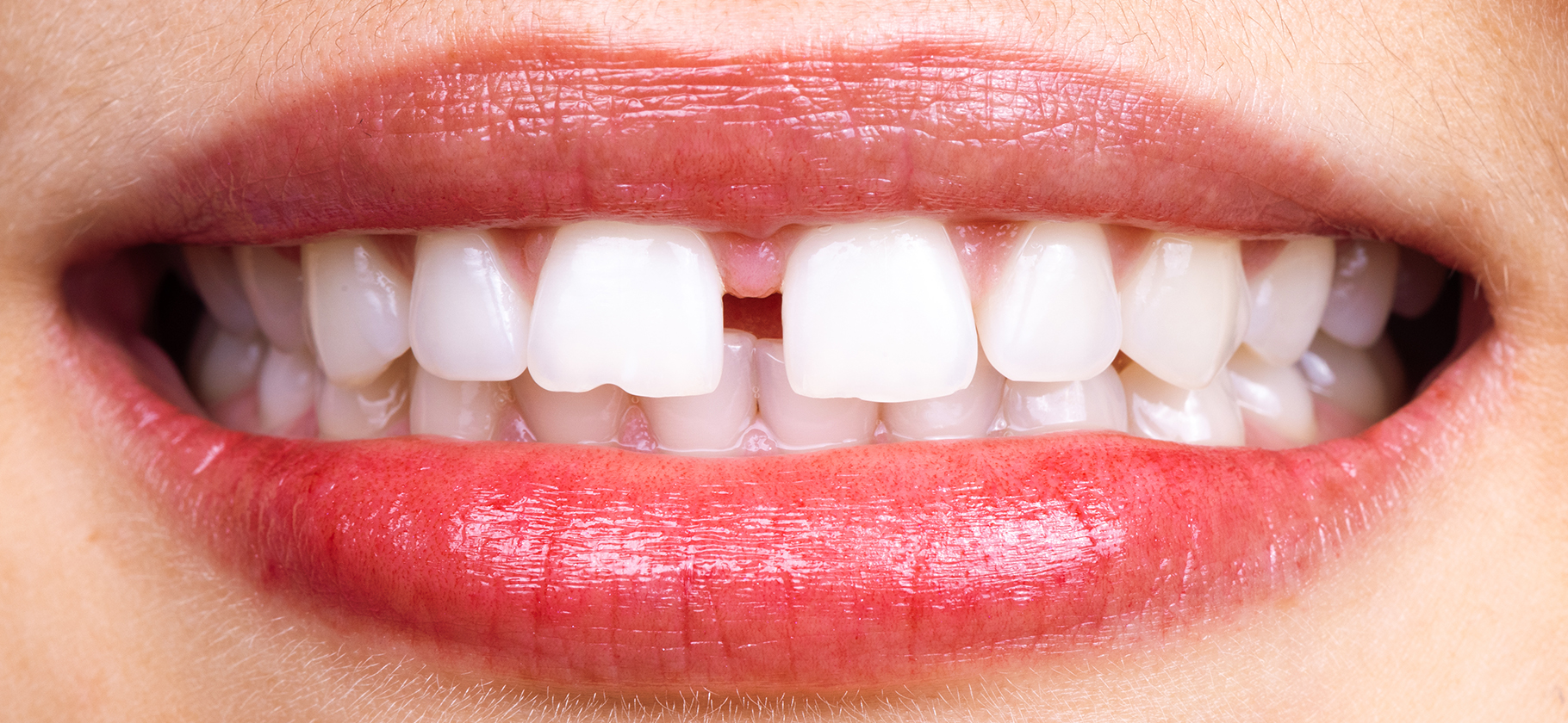 Как получить вычет за лечение зубов