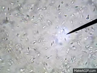 Здоровая сперма под&nbsp;микроскопом: видно, что почти все сперматозоиды энергично двигаются