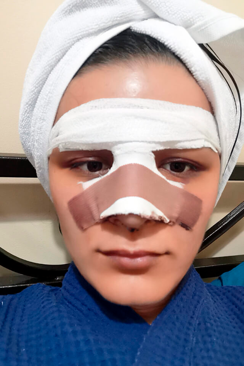 Седьмой день после операции, завтра снимут гипс. Не выдержала и помыла голову