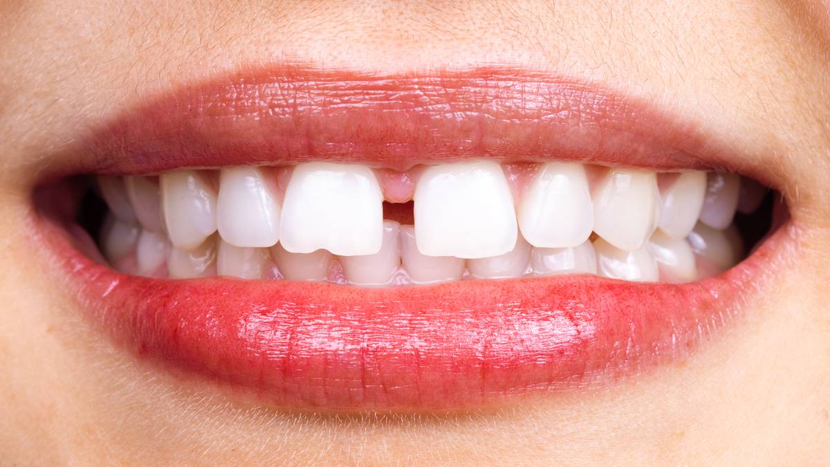 Как получить вычет за лечение зубов