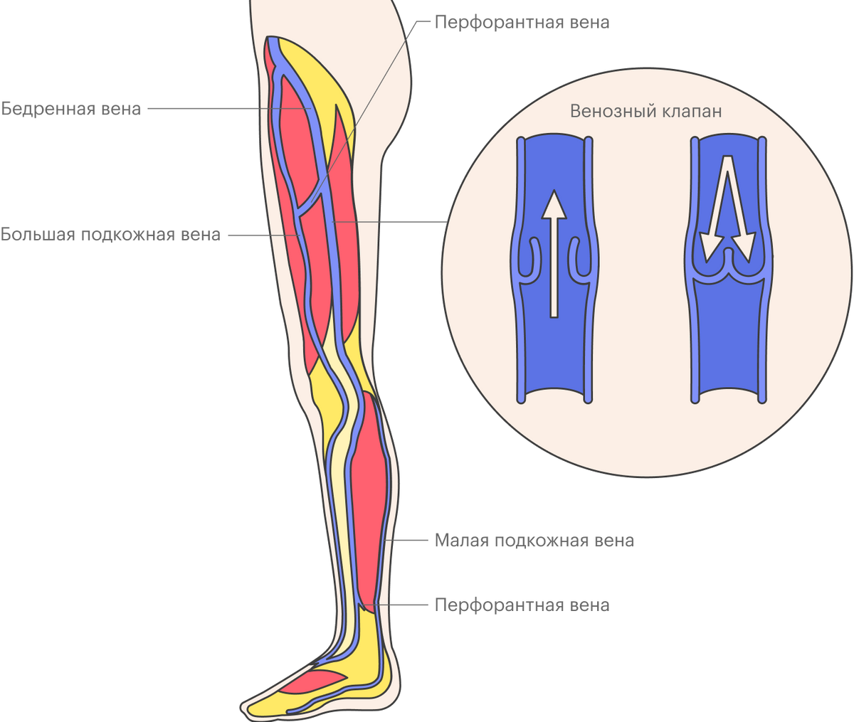 Вены ног делят на&nbsp;глубокие и&nbsp;поверхностные, они связаны перфорантными венами. Большая подкожная вена и&nbsp;малая подкожная вена — поверхностные вены, которые чаще всего становятся «источником» варикоза, а&nbsp;бедренная вена — это осевая глубокая вена. При&nbsp;варикозном расширении поверхностных вен происходит выброс — «утечка» крови — из&nbsp;глубоких вен в поверхностные в&nbsp;местах их соединений или по&nbsp;перемычкам — перфорантным венам. Также внутри вен есть клапаны, мешающие крови двигаться вниз. При&nbsp;варикозном расширении поверхностных вен клапаны деформируются и&nbsp;разрушаются, постепенно развивается венозная недостаточность. Недостаточность клапанов может быть и&nbsp;в&nbsp;глубоких венах, но&nbsp;встречается такое реже