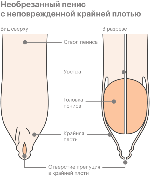 Обрезание Фото Через 2 Недели