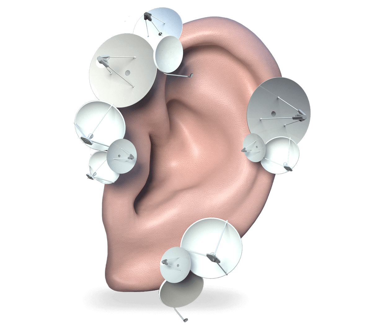 Как получить компенсацию за слуховой аппарат