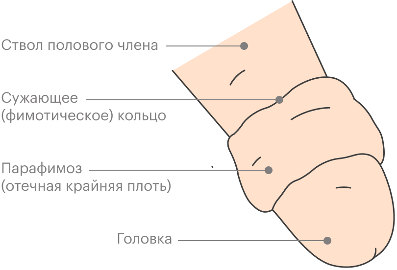 Обрезание картинки html