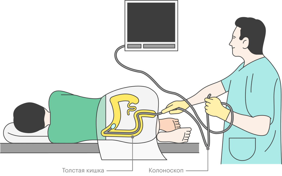 Изображение с камеры выводится на экран. Это позволяет врачу подробно разглядеть, что происходит в кишечнике пациента