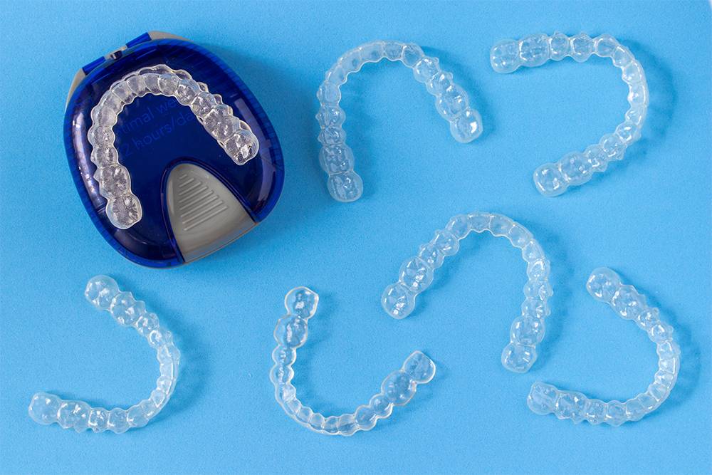 Элайнеры: съемные прозрачные капы для&nbsp;зубов. Источник: 1989studio / Shutterstock