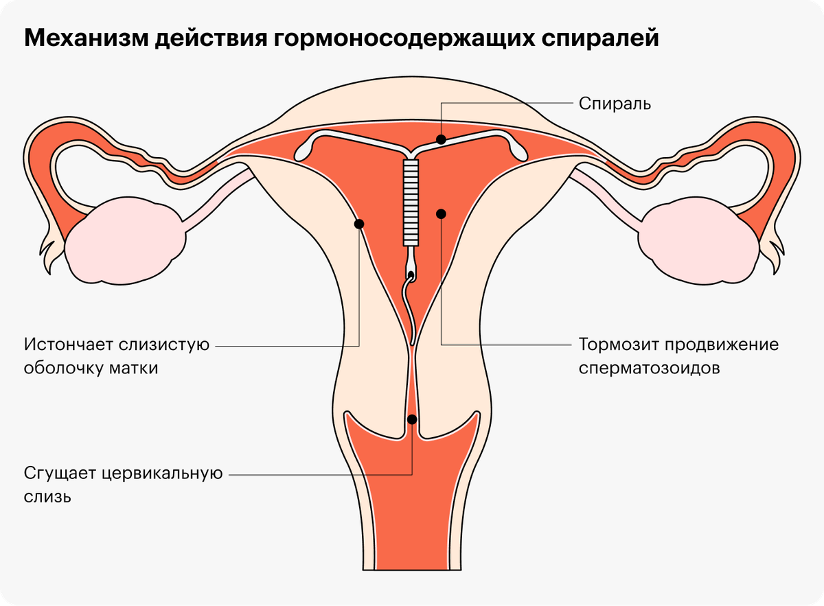 спираль можно ли кончить фото 4