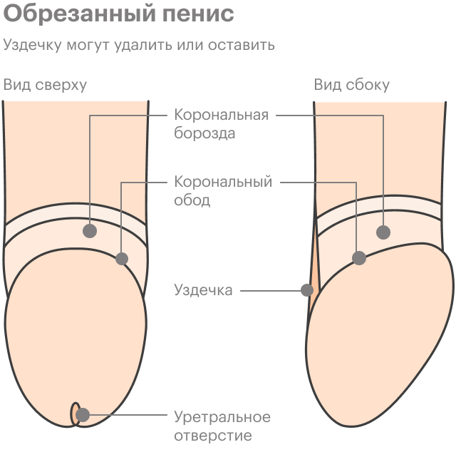 Как Выглядит Обрезание Фото