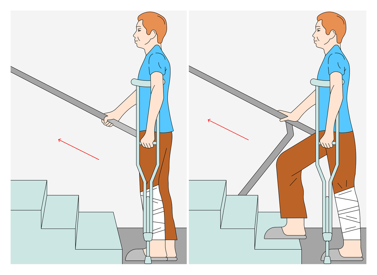 Ходьба на костылях по ступенькам. Техника ходьбы на костылях. Техника хождения на костылях по ступенькам. Костыли лестница.