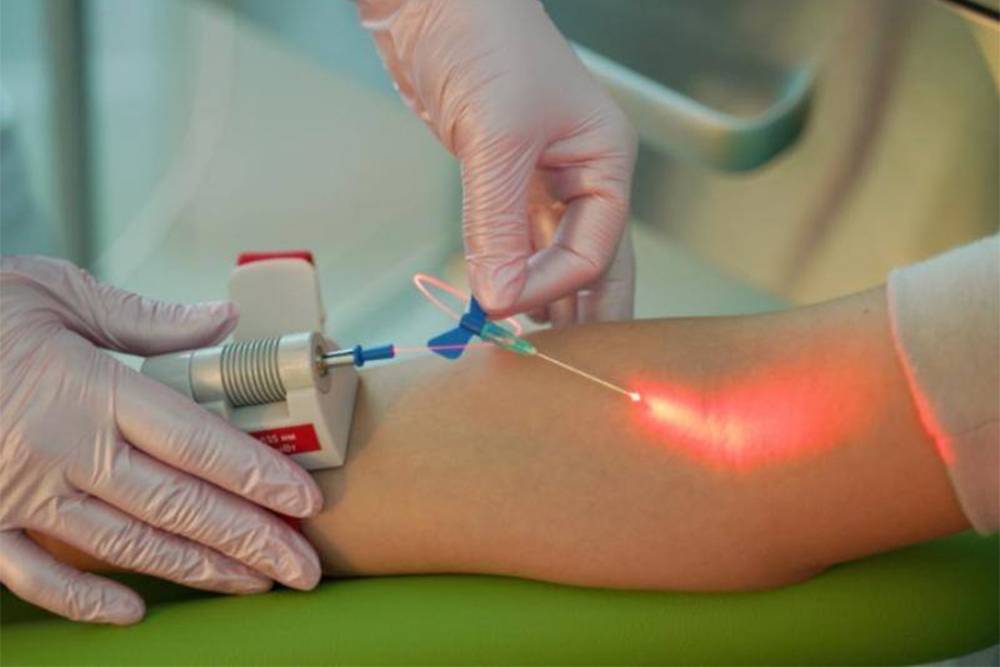Так выглядит процедура лазерного облучения крови. Источник: 1kdmc.ru