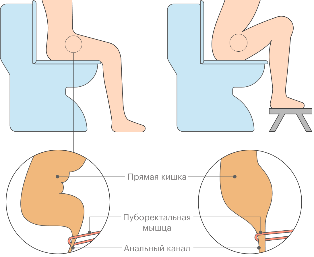 Больно ходить в туалет. Поза для дефекации. Правильная поза при дефекации. Физиологичная поза для дефекации. Как правильно какать.