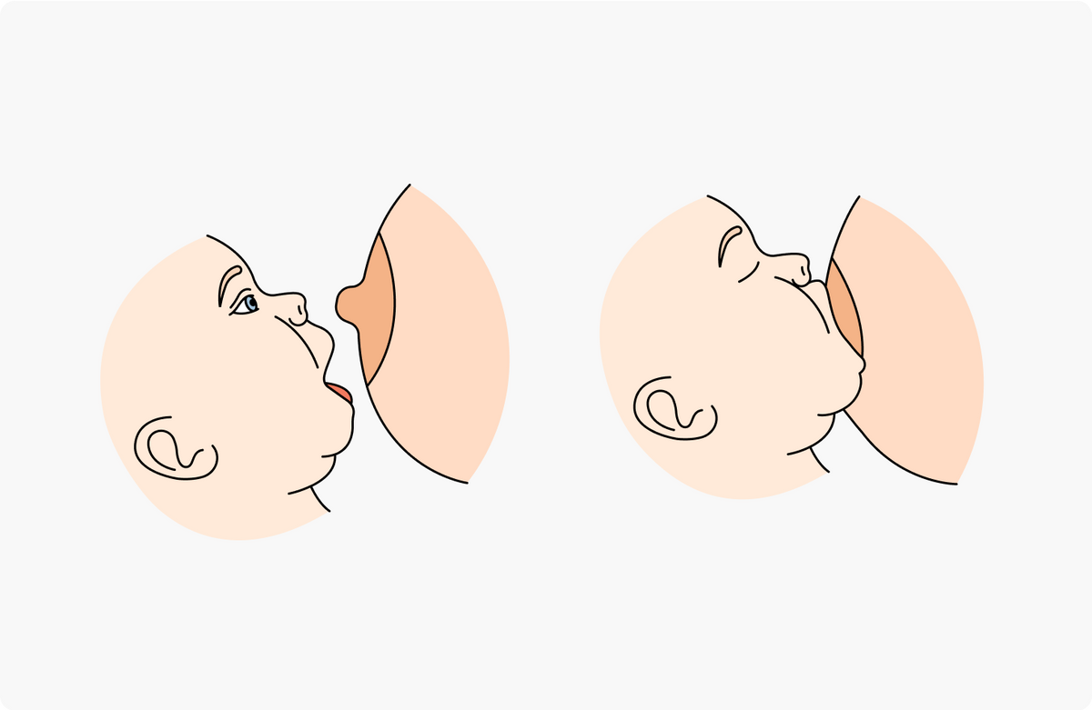Так выглядит правильный захват груди младенцем: во рту должен оказаться не только сосок, но и большая часть ареолы