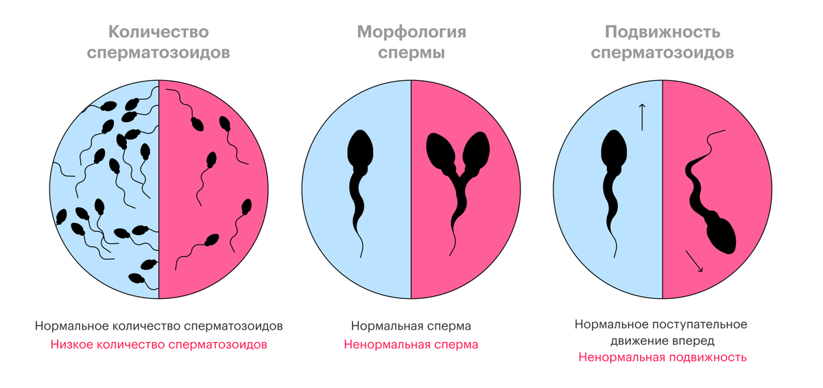 Три критерия здоровья сперматозоидов: количество, форма и подвижность. В синем поле — здоровая сперма, в&nbsp;красном — не&nbsp;очень