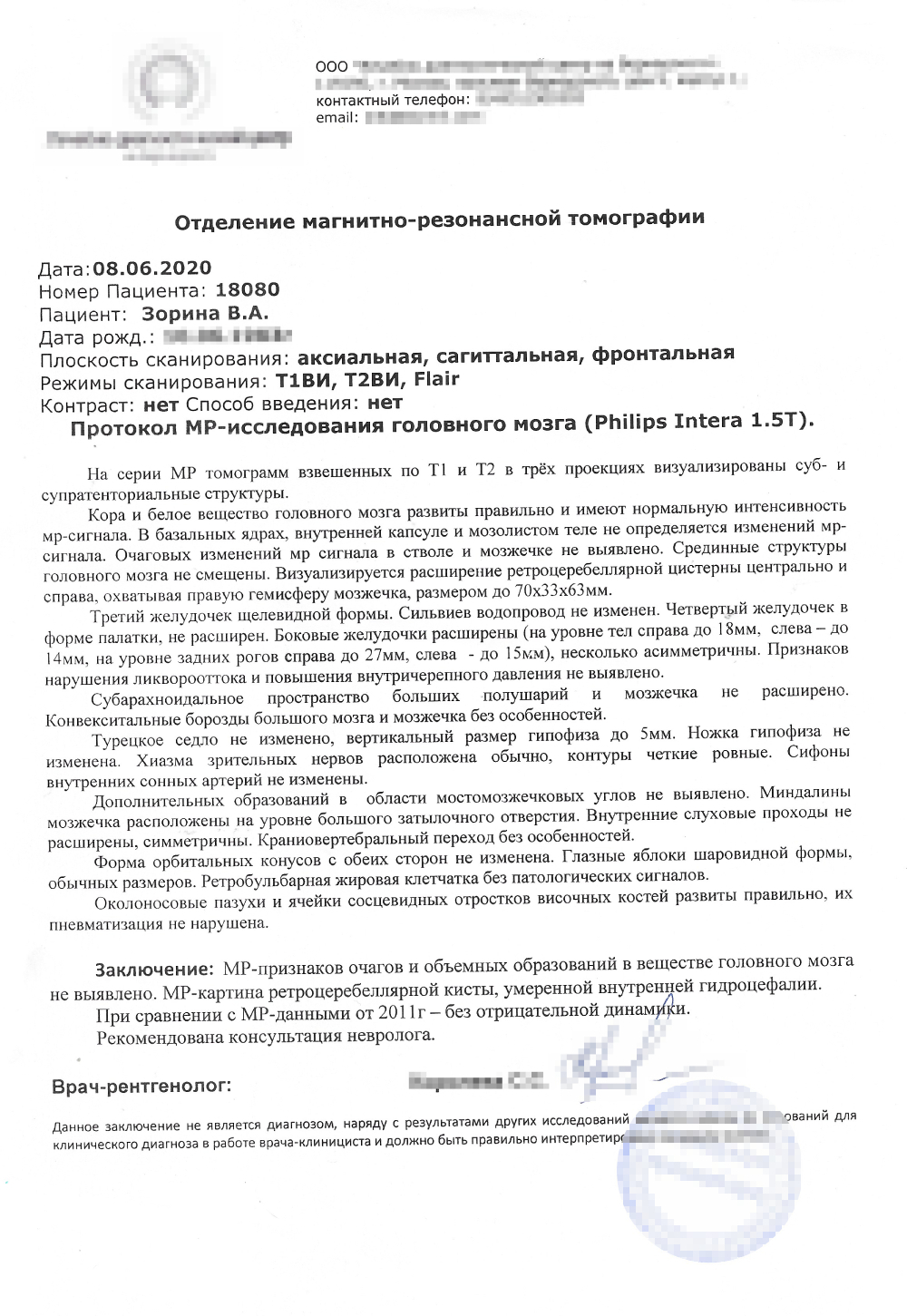 МРТ головного мозга, сделанная в 2020 году: киста на месте, все в порядке