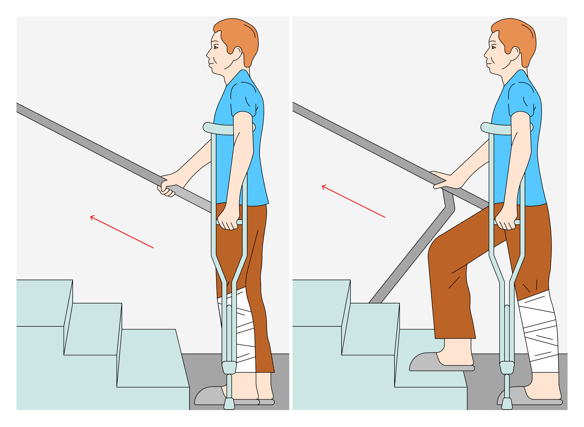 Как правильно подниматься на костылях по лестнице