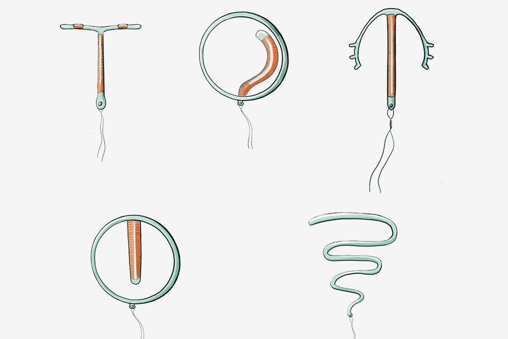 Спираль от беременности минусы. Внутриматочные контрацептивы спирали. Внутриматочная контрацепция (ВМК). Медьсодержащая внутриматочная спираль. ВМК спираль.